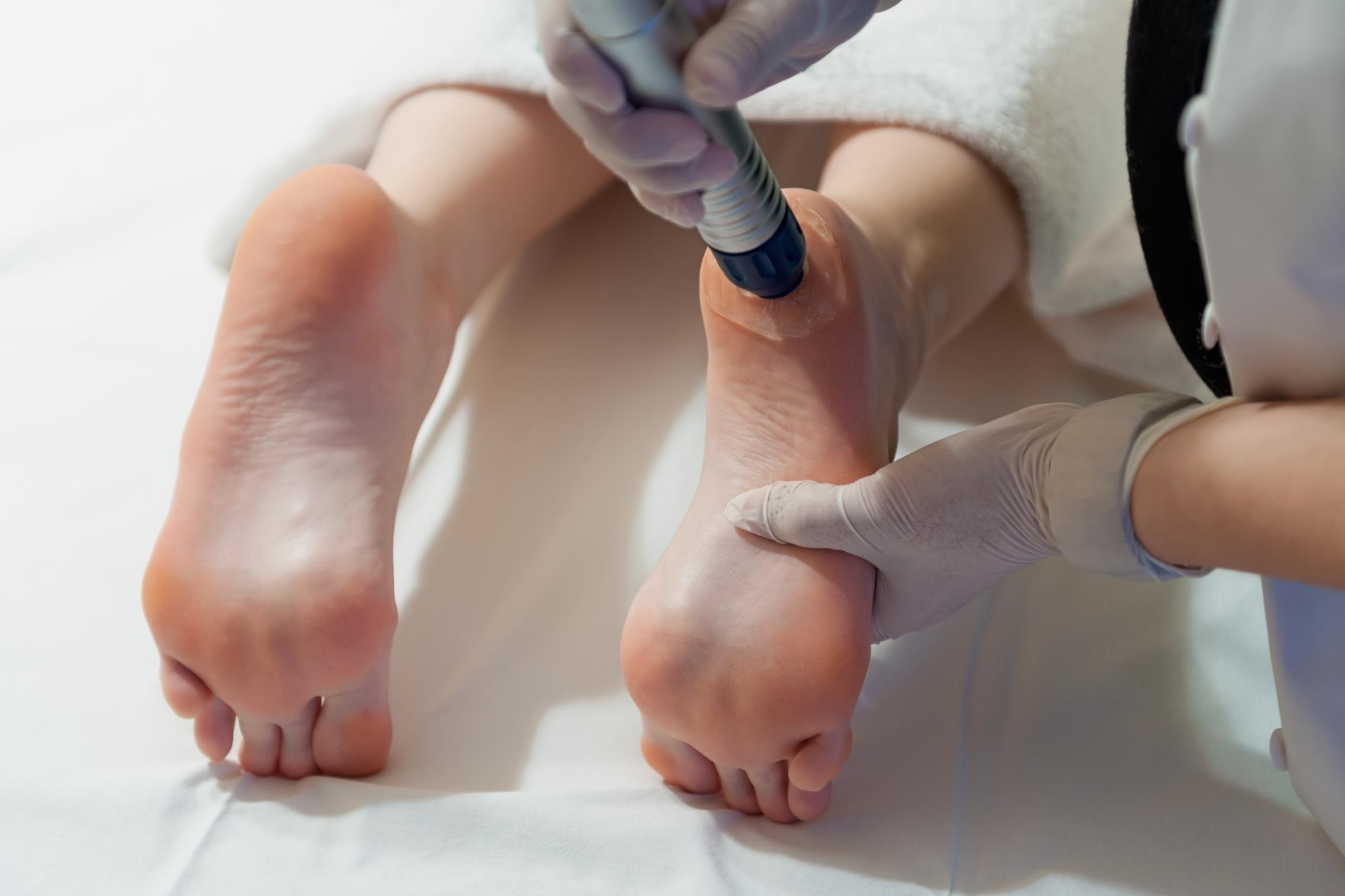 shockwave therapy